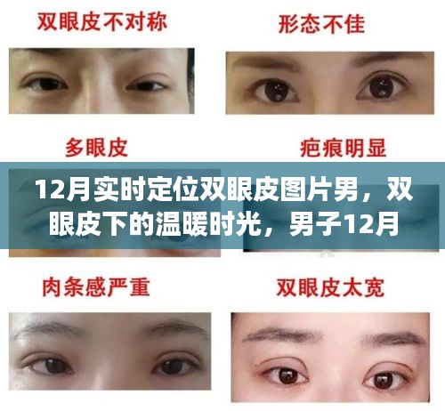 男子雙眼皮恢復之旅，冬季溫暖時光與友情的碰撞