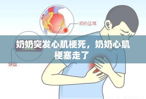 奶奶突發(fā)心肌梗死，奶奶心肌梗塞走了 