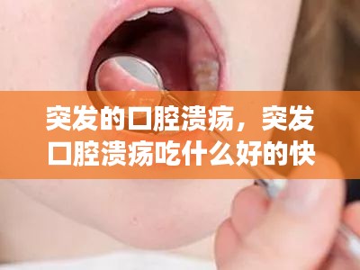 突發(fā)的口腔潰瘍，突發(fā)口腔潰瘍吃什么好的快 