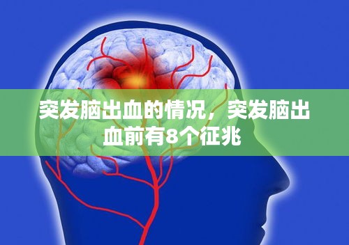 突發(fā)腦出血的情況，突發(fā)腦出血前有8個征兆 