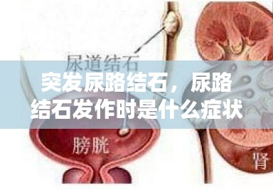 突發(fā)尿路結(jié)石，尿路結(jié)石發(fā)作時是什么癥狀? 