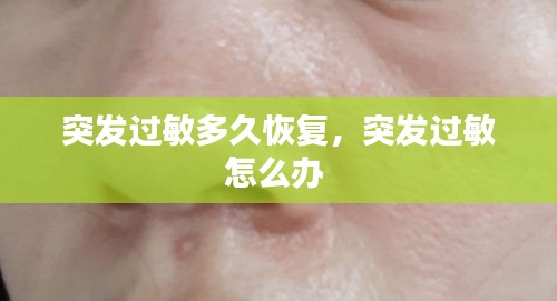 突發(fā)過敏多久恢復(fù)，突發(fā)過敏怎么辦 