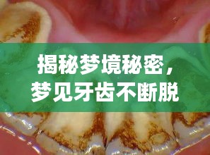 揭秘夢境秘密，夢見牙齒不斷脫落的背后含義