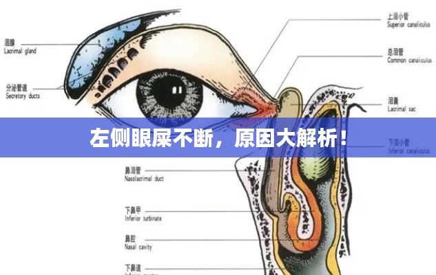 左側(cè)眼屎不斷，原因大解析！
