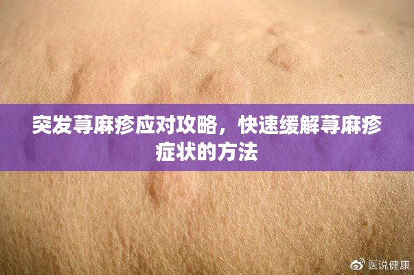 突發(fā)蕁麻疹應(yīng)對攻略，快速緩解蕁麻疹癥狀的方法