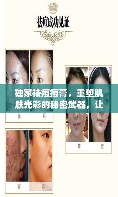 獨家祛痘痘膏，重塑肌膚光彩的秘密武器，讓你擁有無瑕美??！